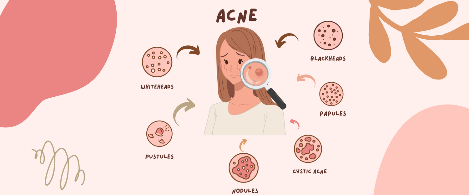 Spending big bucks on various skincare products? Your gut may be the actual skincare you need!
