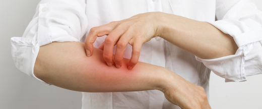 Allergy Alerts: Is Your Gut Microbiome the real culprit?